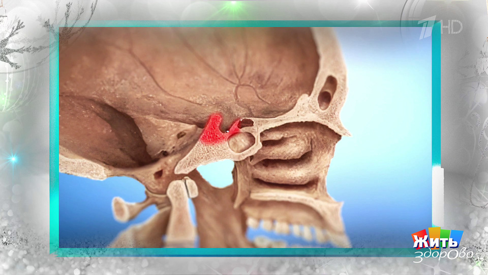 Пустое седло: редкая болезнь, которую нужно знать. Жить здорово! Фрагмент выпуска от 25.12.2025