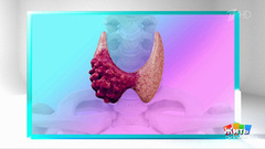 Узел в щитовидке: паниковать или действовать? Жить здорово! Фрагмент 