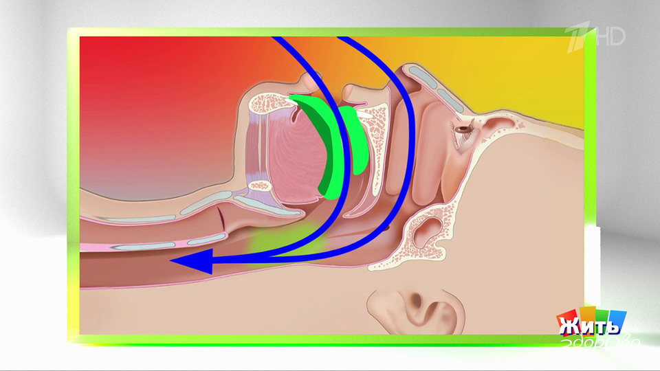 Капы от храпа: чудо или миф? Жить здорово! Фрагмент выпуска от 29.01.2026