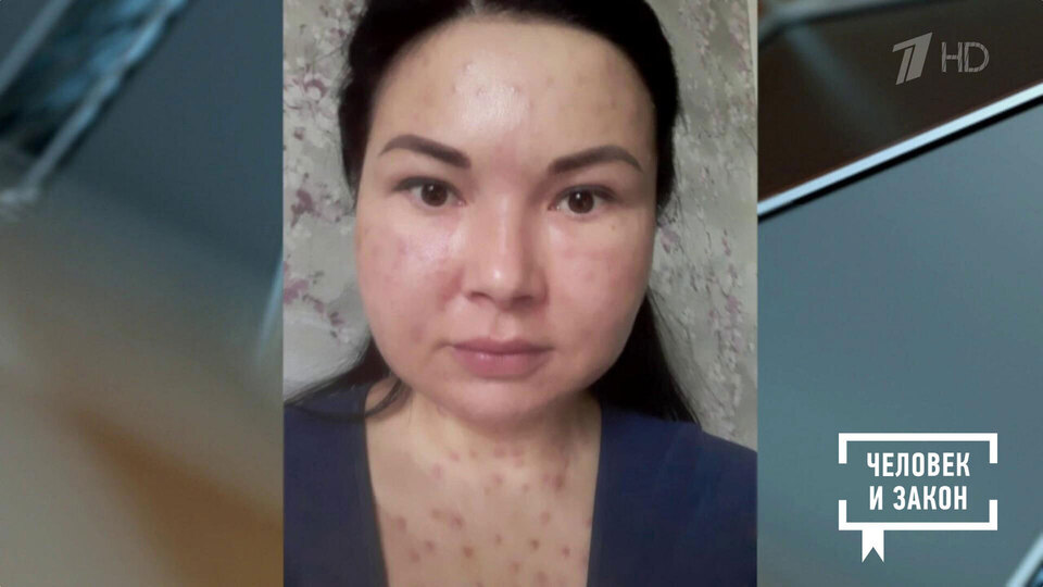 Контроль качества. Пластическая хирургия. Человек и закон. Фрагмент выпуска от 30.01.2026