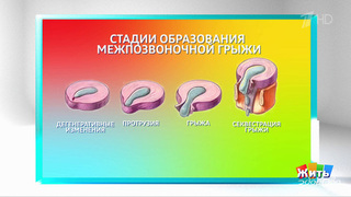 Прострел: когда тело предупреждает? Жить здорово! Фрагмент 
