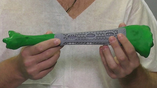 Высокотехнологичная медицина для наших бойцов выходит на новый уровень