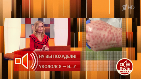 «Лечение последствий заняло два года!» Косметолог рассказала, как купила подделку на маркетплейсе. Пусть говорят! Фрагмент