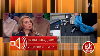 Блогер нарастила зуб гелем для ногтей. Врач-стоматолог рассказал о последствиях такого эксперимента. Пусть говорят! Фрагмент 