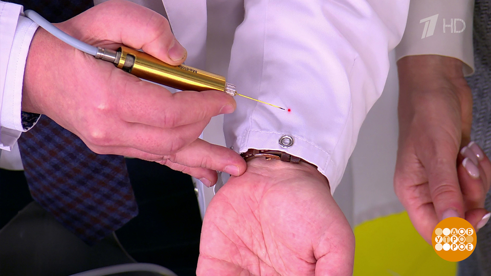 Бородавки, которые стыдно показать. Жить здорово! Фрагмент выпуска от 18.02.2026