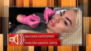 Гиалуроновая долина: девушка с самыми большими в России губами рассказала, сколько тратит на свою красоту