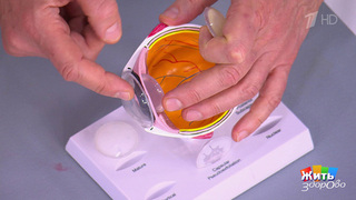 Врач или технология? Выбирайте точность, а не рекламу. Жить здорово! Фрагмент 