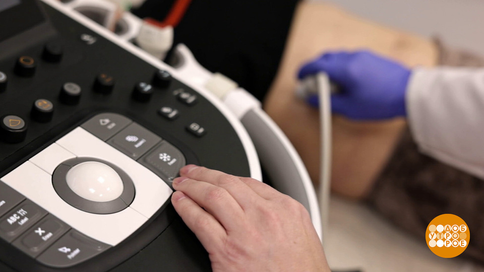 Проверьте ваши почки! Доброе утро. Фрагмент выпуска от 12.03.2026