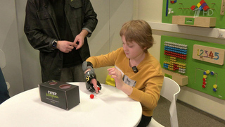 Мальчику, который получил тяжелую травму при взрыве в Красногорске, изготовили суперсовременный протез