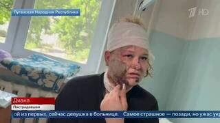«Осколки из затылка и шеи вынимали» — пострадавшая студентка из Старобельска о последствиях удара ВСУ
