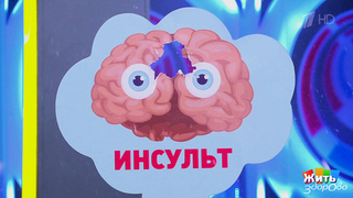 Врачи объяснили, почему во время секса может возникнуть инсульт