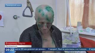 Выживший после нападения медведицы рассказал подробности схватки с хищником